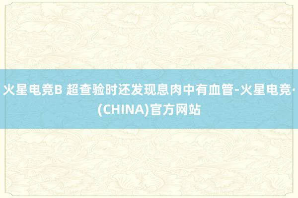 火星电竞B 超查验时还发现息肉中有血管-火星电竞·(CHINA)官方网站